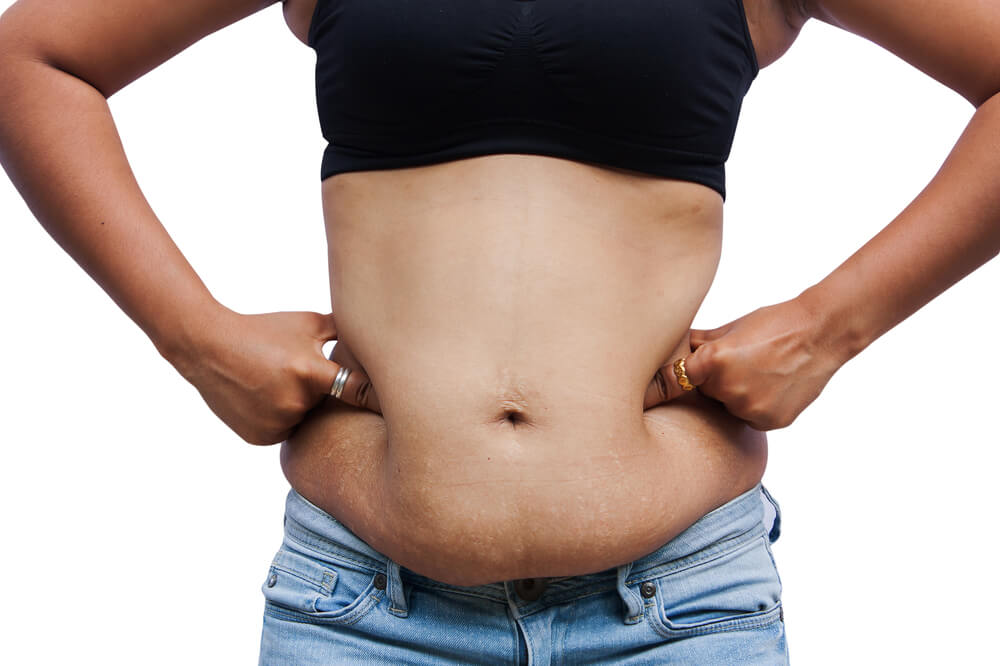 How To Get Rid Of Excess Skin After Weight Loss Gym Junkies