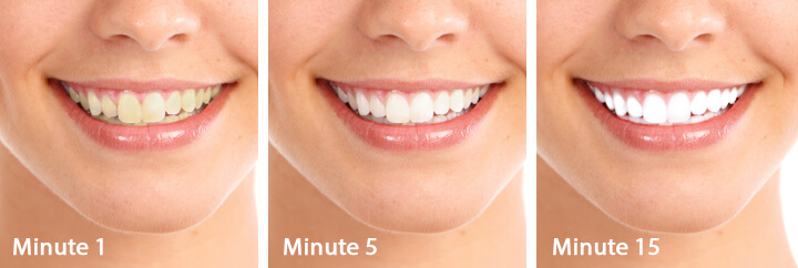 How to use white smile