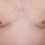 How To Get Rid Of Puffy Nipples With Diet & Exercises