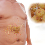 Visceral Fat And Why It’s So Dangerous